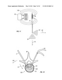 Spinous Navigation System and Associated Methods diagram and image