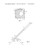 Spinous Navigation System and Associated Methods diagram and image