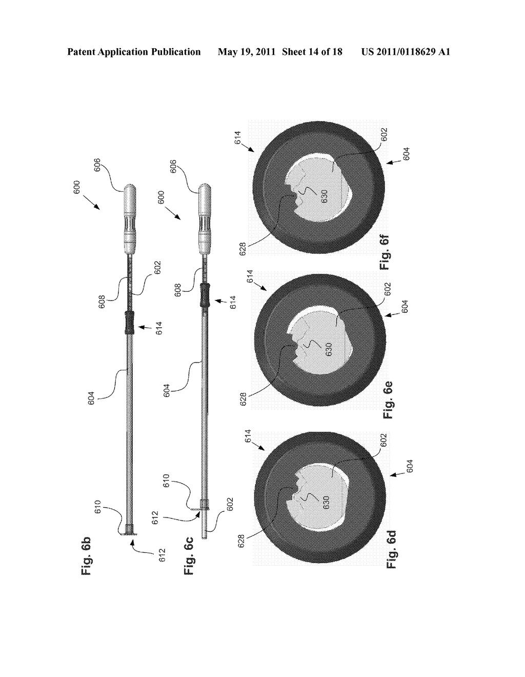 DEVICES AND METHODS FOR CERVIX MEASUREMENT - diagram, schematic, and image 15