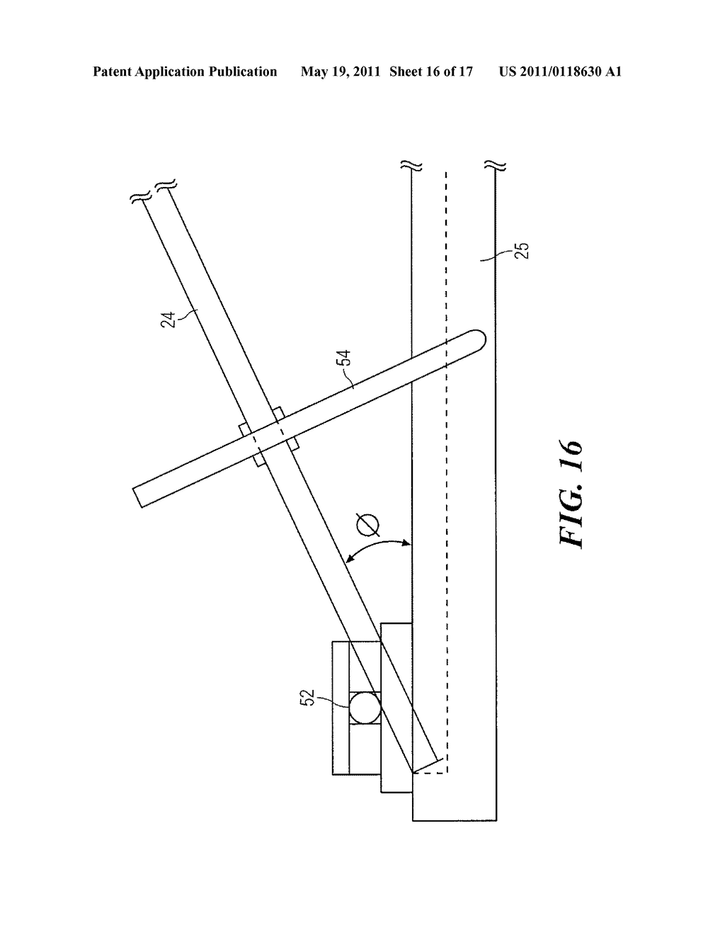 ANKLE-FOOT ORTHOSIS PRESCRIPTION ASSISTIVE DEVICE - diagram, schematic, and image 17