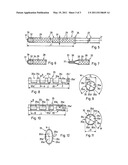 METHOD AND DEVICE FOR THE TREATMENT OF GLAUCOMA diagram and image