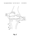 Device,system, and method for targeted delivery of anti-inflammatory medicaments to a mammalian subject diagram and image