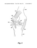 Device,system, and method for targeted delivery of anti-inflammatory medicaments to a mammalian subject diagram and image