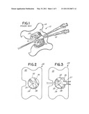 CATHETER SECUREMENT DEVICE diagram and image