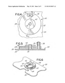 CATHETER SECUREMENT DEVICE diagram and image