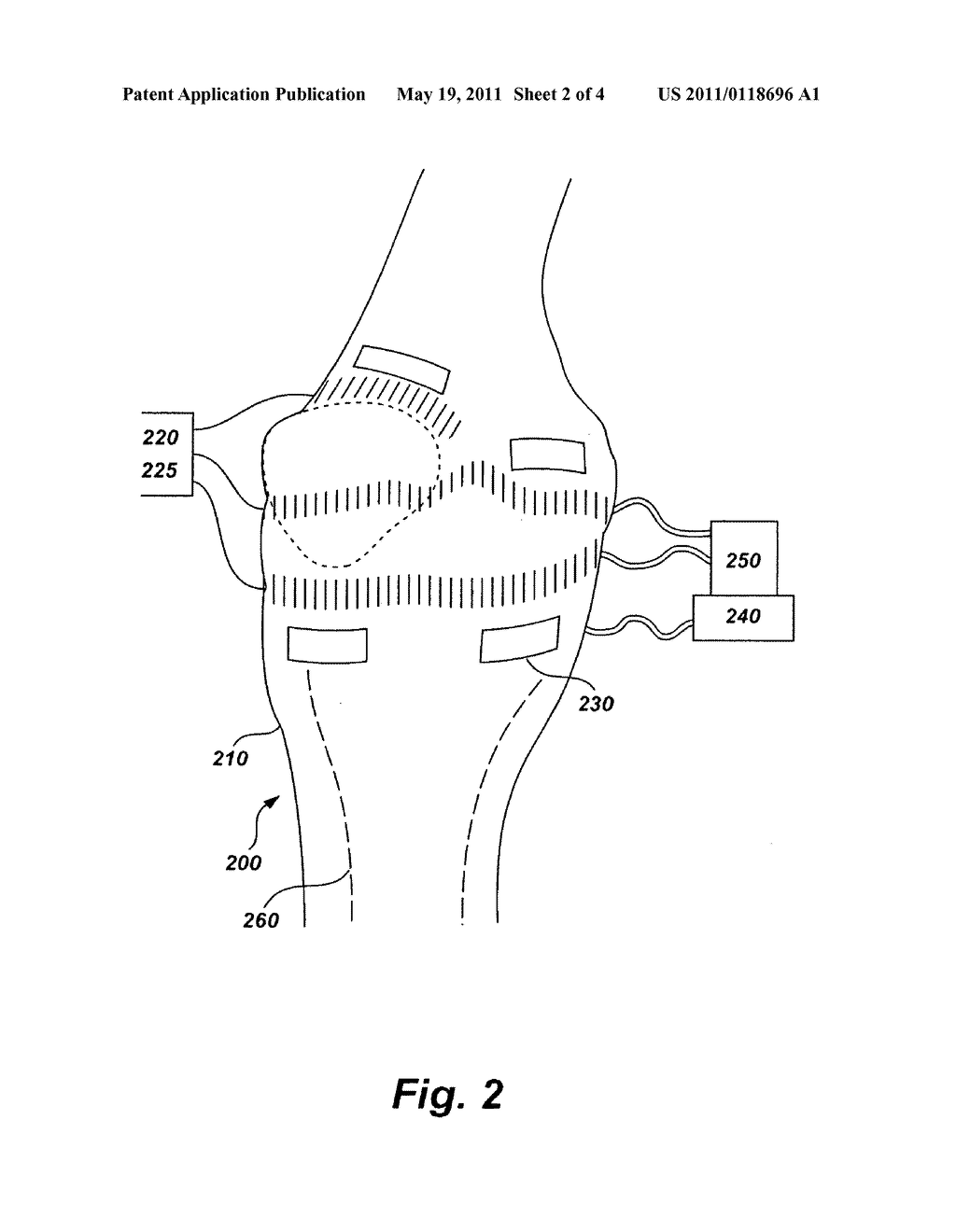 Device, system, and method for targeted delivery of anti-inflammatory medicaments to a mammalian subject - diagram, schematic, and image 03