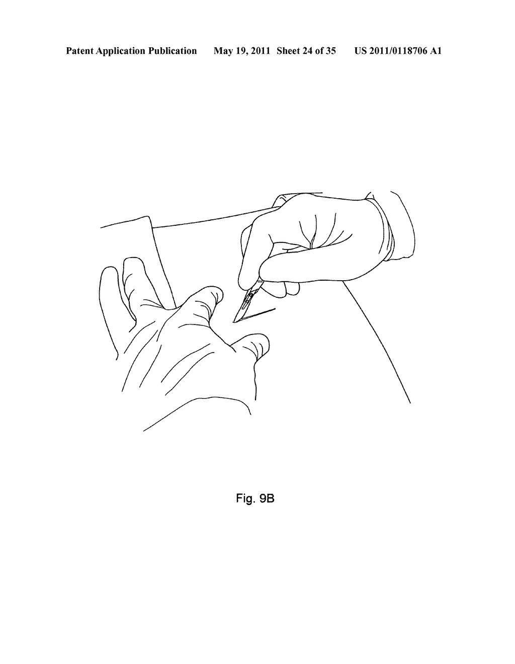  Device Suitable for Use During Deployment of a Medical Device - diagram, schematic, and image 25