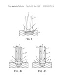 SAFE ABLATION diagram and image