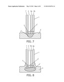 SAFE ABLATION diagram and image