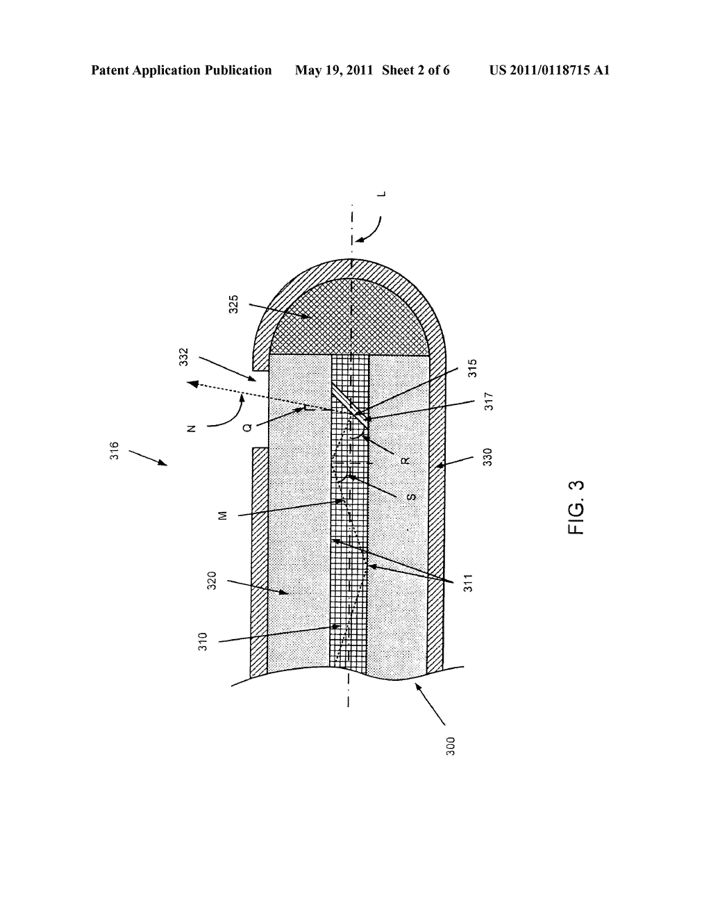 METHODS AND APPARATUS RELATED TO A SIDE-FIRE ASSEMBLY THAT HAS AN OPTICAL GRATING - diagram, schematic, and image 03