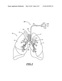 NON-INVASIVE AND MINIMALLY INVASIVE DENERVATION METHODS AND SYSTEMS FOR PERFORMING THE SAME diagram and image