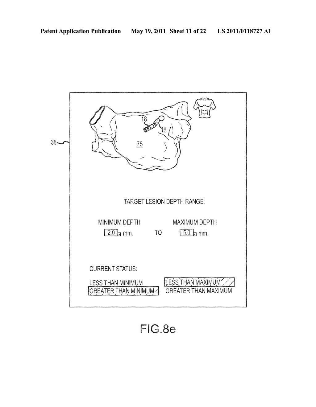 SYSTEM AND METHOD FOR ASSESSING THE FORMATION OF A LESION IN TISSUE - diagram, schematic, and image 12