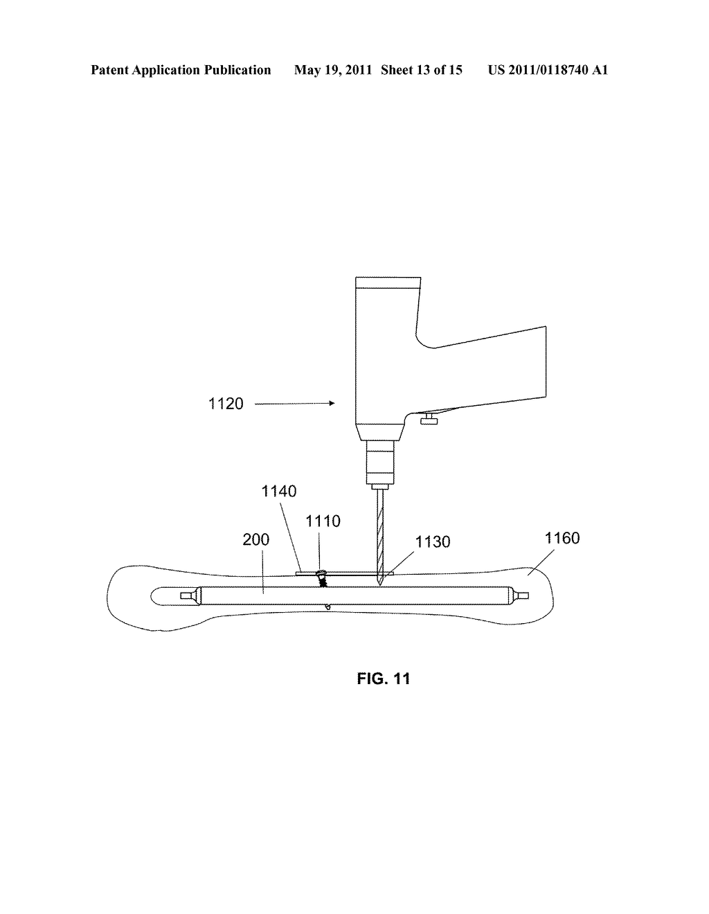 Intramedullary Implants Having Variable Fastener Placement - diagram, schematic, and image 14