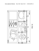 Integrated Surgical Cutting System diagram and image