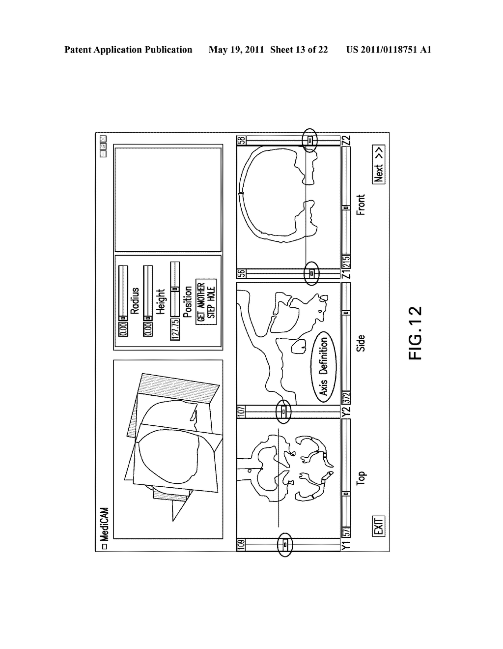 Integrated Surgical Cutting System - diagram, schematic, and image 14