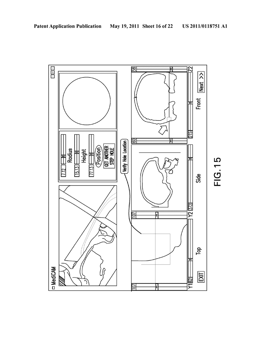 Integrated Surgical Cutting System - diagram, schematic, and image 17