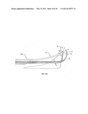 SURGICAL END EFFECTOR APPARATUS AND METHOD diagram and image