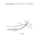 SURGICAL END EFFECTOR APPARATUS AND METHOD diagram and image