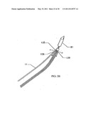 SURGICAL END EFFECTOR APPARATUS AND METHOD diagram and image