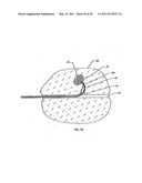 SURGICAL END EFFECTOR APPARATUS AND METHOD diagram and image