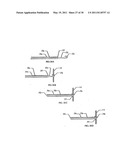 SURGICAL END EFFECTOR APPARATUS AND METHOD diagram and image