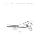 SURGICAL END EFFECTOR APPARATUS AND METHOD diagram and image