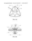 ANASTOMOSIS STENT diagram and image