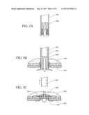 ANASTOMOSIS STENT diagram and image