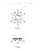 ANASTOMOSIS STENT diagram and image