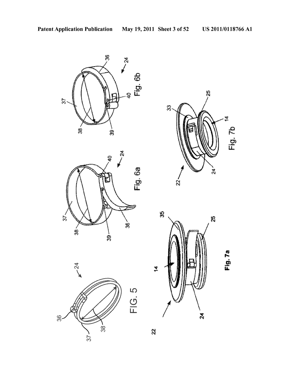 Attachment System, Device and Method - diagram, schematic, and image 04