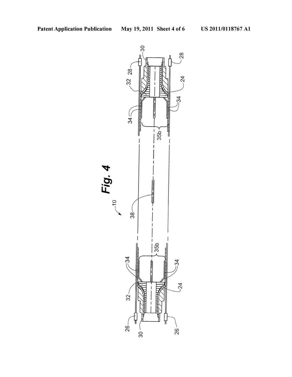 Method and Apparatus for Determining Status of Approximation Structures on Anastomosis Device - diagram, schematic, and image 05