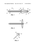 OCCLUSIVE CINCHING DEVICES AND METHODS OF USE diagram and image