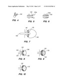 OCCLUSIVE CINCHING DEVICES AND METHODS OF USE diagram and image