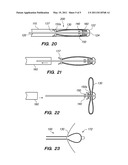 OCCLUSIVE CINCHING DEVICES AND METHODS OF USE diagram and image