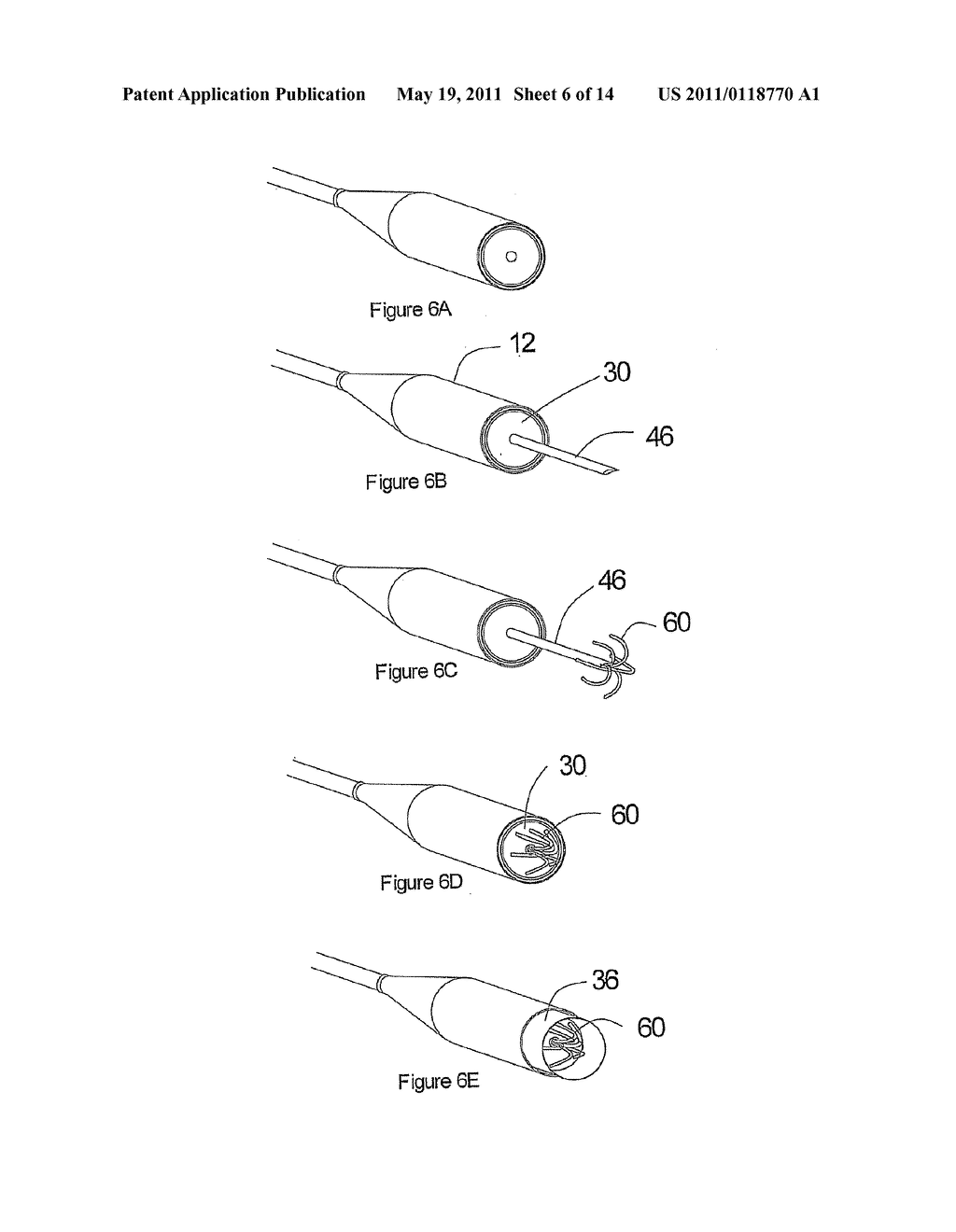 VESSEL CUTTING TOOL - diagram, schematic, and image 07
