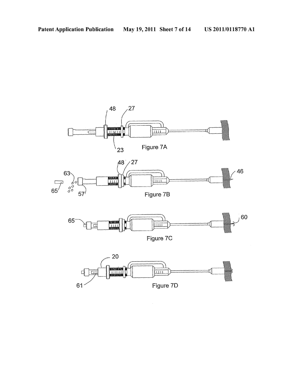 VESSEL CUTTING TOOL - diagram, schematic, and image 08