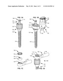 LOAD-SHARING BONE ANCHOR HAVING A FLEXIBLE POST AND METHOD FOR DYNAMIC STABILIZATION OF THE SPINE diagram and image