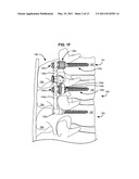 LOAD-SHARING BONE ANCHOR HAVING A FLEXIBLE POST AND METHOD FOR DYNAMIC STABILIZATION OF THE SPINE diagram and image