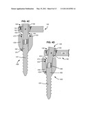 LOAD-SHARING BONE ANCHOR HAVING A FLEXIBLE POST AND METHOD FOR DYNAMIC STABILIZATION OF THE SPINE diagram and image