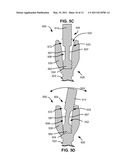 LOAD-SHARING BONE ANCHOR HAVING A FLEXIBLE POST AND METHOD FOR DYNAMIC STABILIZATION OF THE SPINE diagram and image