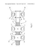 Cervical Plate Ratchet Pedicle Screws diagram and image