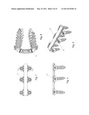 Cervical Plate Ratchet Pedicle Screws diagram and image