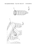 Cervical Plate Ratchet Pedicle Screws diagram and image