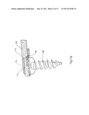 Cervical Plate Ratchet Pedicle Screws diagram and image