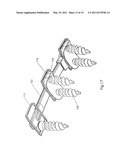 Cervical Plate Ratchet Pedicle Screws diagram and image