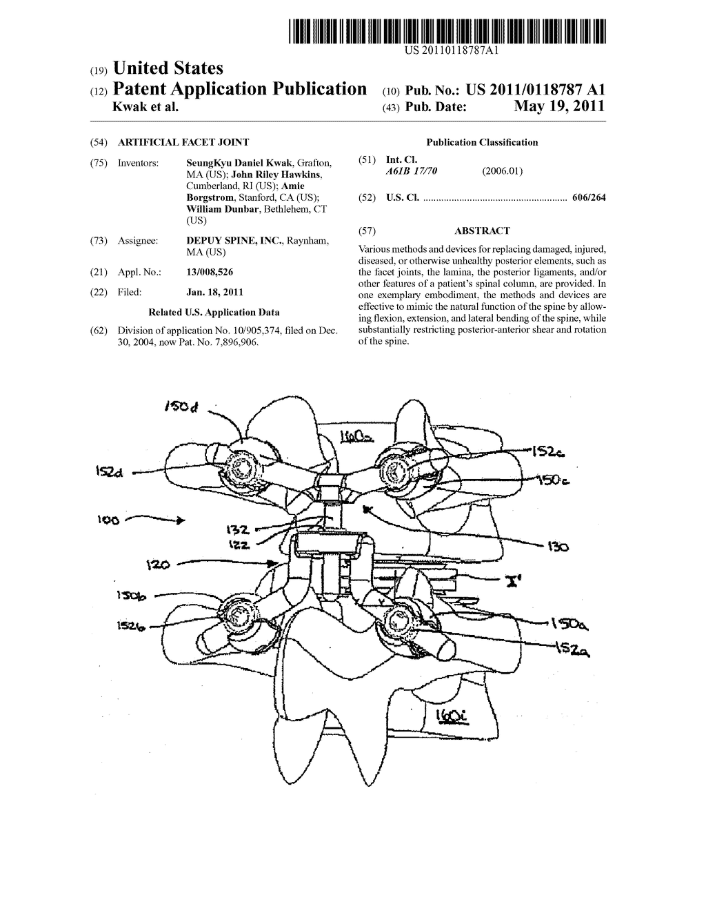 ARTIFICIAL FACET JOINT - diagram, schematic, and image 01