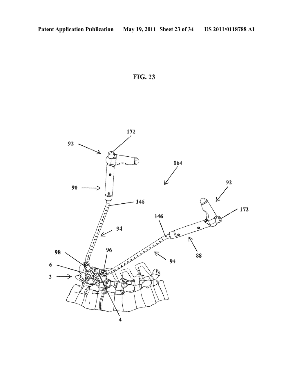 Intervertebral Implant Devices And Methods For Insertion Thereof - diagram, schematic, and image 24