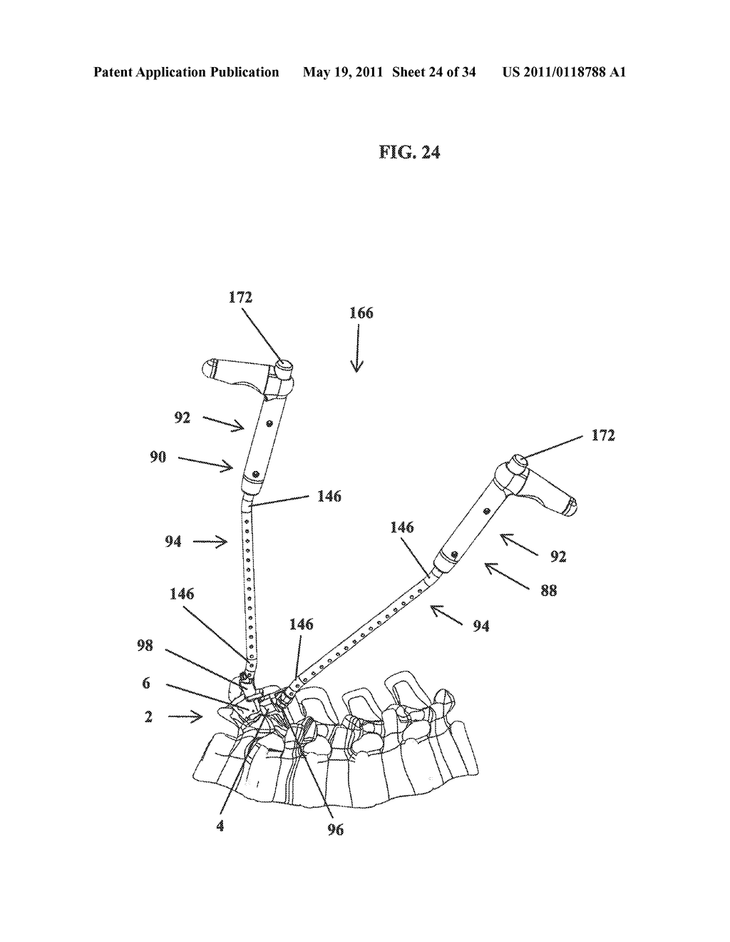 Intervertebral Implant Devices And Methods For Insertion Thereof - diagram, schematic, and image 25