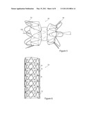 Stent Graft and Introducer Assembly diagram and image