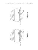 STENT DELIVERY SYSTEM diagram and image